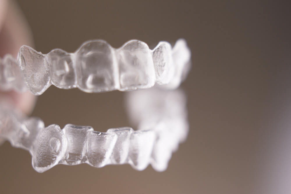 יישור שיניים invisalign מחיר